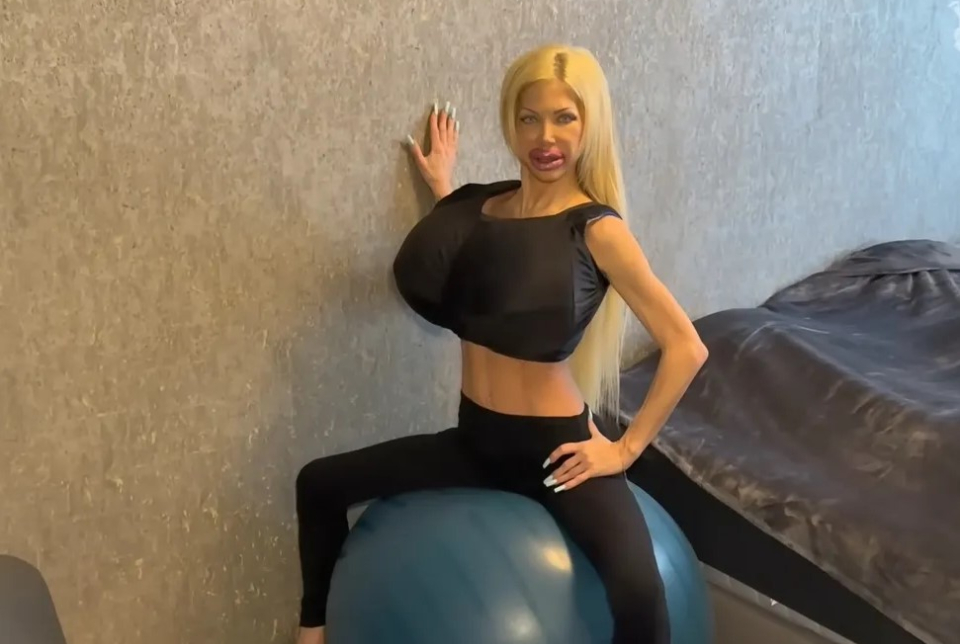 Rekorder implantátumok: ki vállalja a felelősséget?